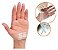 Kit Adesivo Cirúrgico 60cm Steristrip + Exofin 1mL - Kelogel - Imagem 4