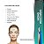 FIOS PDO BIOESTIMULADOR MONO 27G 60MM 90MM AG MG PRODEEP - CX/10 - ALUR - Imagem 5
