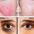 Massageador Facial Silicone Rolo De Gelo Para Rosto Rolinho Reutilizável Alívio De Inchaço Olheira - Imagem 5