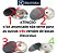 KIT BACIAS E QUEIMADORES ELECTROLUX - Imagem 2