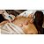 Kit 12 Ventosas Terapêuticas e Massageadoras para Saúde e Beleza - Imagem 5