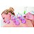 Kit 12 Ventosas Terapêuticas e Massageadoras para Saúde e Beleza - Imagem 3