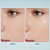Beauty of Joseon - Matte Sun Stick SPF 50+ (18g) - Imagem 3