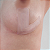 Fita de silicone em L para Mamas Siliskin – Tratamento de Cicatrizes (2 unidades) - Imagem 1
