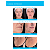 Skin Booster Saypha Rich Com 1 Seringa de 1ml- CROMA - Imagem 5
