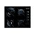Cooktop a Gás 4 Bocas Brastemp BRBDT62AEUNA Preto Bivolt - Imagem 1