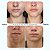 Acnano BlueActive Tônico Oil Control Antiacne - 200ml - Imagem 6