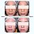 KIT ROTINA COMPLETA Antiacne Acnano BlueActive + Frasqueira - Imagem 3
