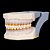 Manequim Para Periodontia 32 Dentes Fixos com Simulação de Tártaro - Imagem 6