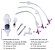 Sonda Botton Para Gastrostomia 24Fr X 1,7cm GMI - Imagem 3