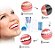 Kit Super de Clareamento Dental Laser - Home Kit Whitening Gel com 44% Peróxido de Carbamida - Imagem 3