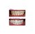 Kit Super de Clareamento Dental Laser - Home Kit Whitening Gel com 44% Peróxido de Carbamida - Imagem 7