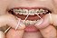 Passa Fio - Condutor dental Powerline c/ 30 refis - Imagem 2