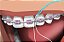 Passa Fio - Condutor dental Powerline c/ 30 refis - Imagem 1