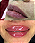 Preenchimento labial - Imagem 3