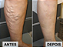 SAÚDE TOTAL HARP 100mg combo 4 potes - Imagem 5