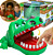 ogo Crocodilo Jacaré Dentista Dente Morde Dedo Brinquedo Fácil de Brincar e Carregar Podendo Várias Crianças Brincarem Juntas - Imagem 1