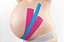 Fita Kinesio Tape Bandagem Elástica - Kelogel  -  5cmX5cm - 1 unidade - Preto - Imagem 8
