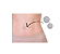 Órtese P/ Umbigo Esférica Perola Abdominoplastia em Silicone - Siliskin - Imagem 2