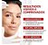 Kit Revitalift Hialurônico Olhos + Laser X3 | L'Oréal Paris - Imagem 9