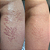 Sérum Revitaliza™ Reparador Tecidual - Pós Procedimentos Sobrancelhas e Estrias - Imagem 12