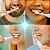 Kess Belliz Soni-K100: Escova Dental Elétrica Sônica com 30.000 Vibrações e Refil Extra para Limpeza Superior - Imagem 5