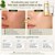 Kit Skin1004 Madagascar Centella: Tônico Facial 210ml e Creme Facial 75 ml - Imagem 6