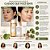 Kit Skin1004 Madagascar Centella: Tônico Facial 210ml, Ampola de Cápsula Iluminadora 100ml e Creme Facial 75ml - Imagem 6