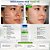 Sabonete Facial Antiacne Nupill Derme Control Niacinamida e Ácido Salicílico 140ml - Imagem 3