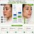 Kit Nupill Derme Control Antiacne: Espuma Facial 150ml e Sabonete Facial 140ml - Imagem 3