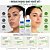 Kit Nupill Derme Control Antiacne: Espuma Facial 150ml e Solução Micelar 140ml - Imagem 3