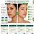 Kit Nupill Derme Control Antiacne: Sabonete Facial 140ml e Solução Micelar 140ml - Imagem 3