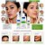 Kit Nupill Derme Control Antiacne: Espuma Facial 150ml, Solução Micelar 140ml e Gel Facial 30g - Imagem 3