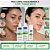 Kit Nupill Derme Control Antiacne: Sabonete Facial 140ml, Solução Micelar 140ml e Gel Facial 30g - Imagem 3