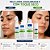 Kit Completo Nupill Derme Control Antiacne - Imagem 3