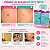 Kit Ricca Adesivos Secativos Para Acnes: Smile + Flor e Estrela 20 Unidades Cada - Imagem 3