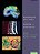Neurologic Outcomes Of Surgery And Anesthesia-.. - Imagem 1