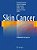 Skin Cancer - A World-Wide Perspective-.. - Imagem 1