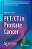 Pet/Ct In Prostate Cancer-.. - Imagem 1