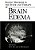 Recent Progress In The Study And Therapy Of Brain Edema-.. - Imagem 1