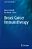 Breast Cancer Immunotherapy-.. - Imagem 1