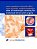 Atlas Of Endoscopic Anatomy For Endonasal Intracranial Surgery-.. - Imagem 1