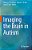 Imaging The Brain In Autism-.. - Imagem 1