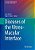Diseases Of The Vitreo-Macular Interface-.. - Imagem 1