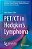 Pet/Ct In Hodgkin's Lymphoma-.. - Imagem 1