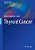 Thyroid Cancer-.. - Imagem 1