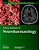 Oxford Textbook Of Neurohaematology-.. - Imagem 1