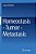 Homeostasis - Tumor - Metastasis-.. - Imagem 1