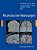 Reconstructive Neurosurgery-.. - Imagem 1