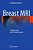 Breast Mri: Fundamentals And Technical Aspects-.. - Imagem 1